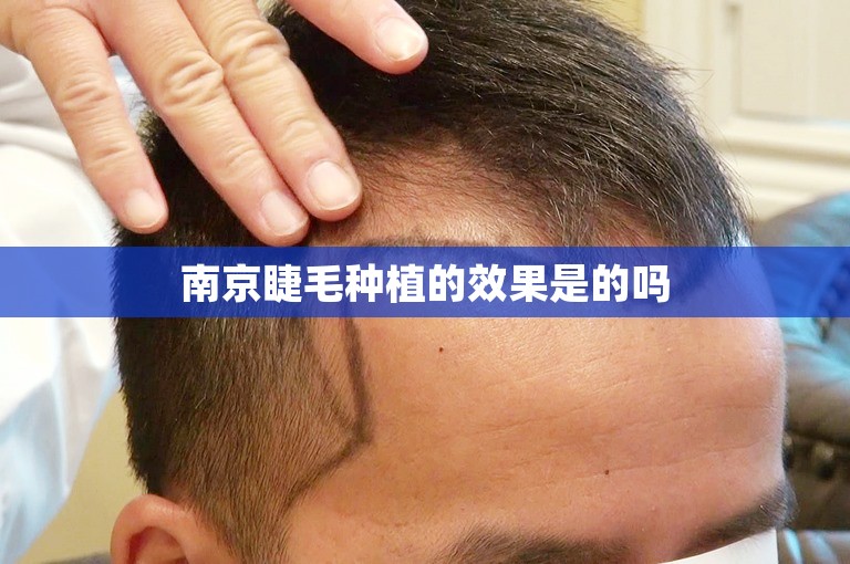 南京睫毛种植的效果是的吗