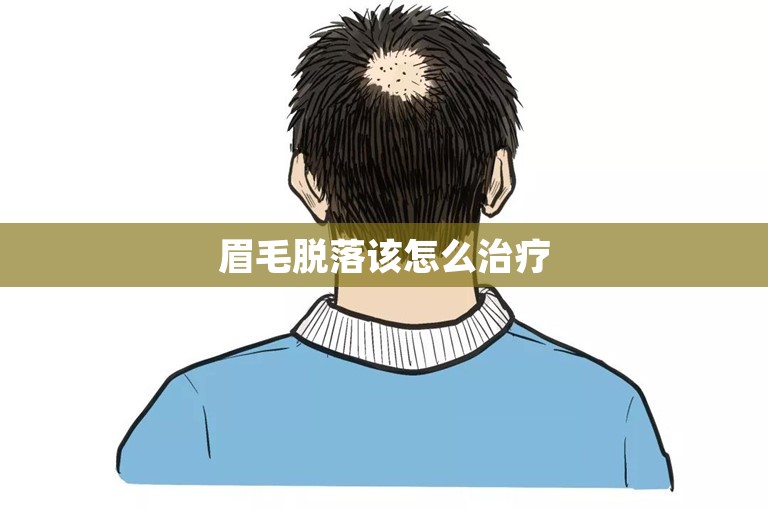 眉毛脱落该怎么治疗