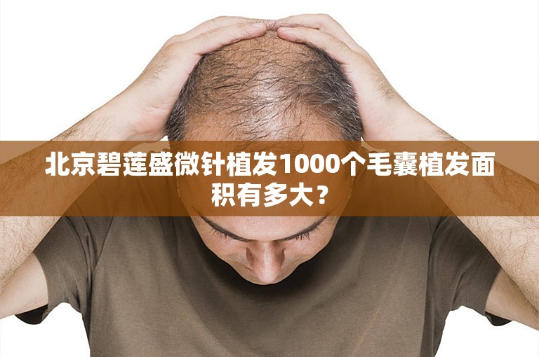 北京碧莲盛微针植发1000个毛囊植发面积有多大？