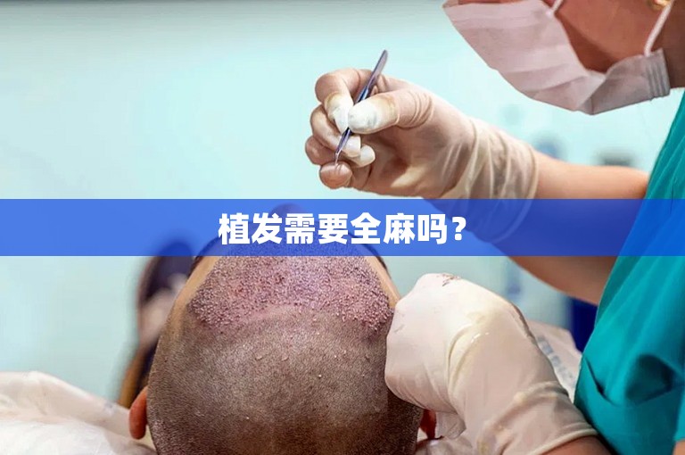 植发需要全麻吗? 植发需要全麻吗?