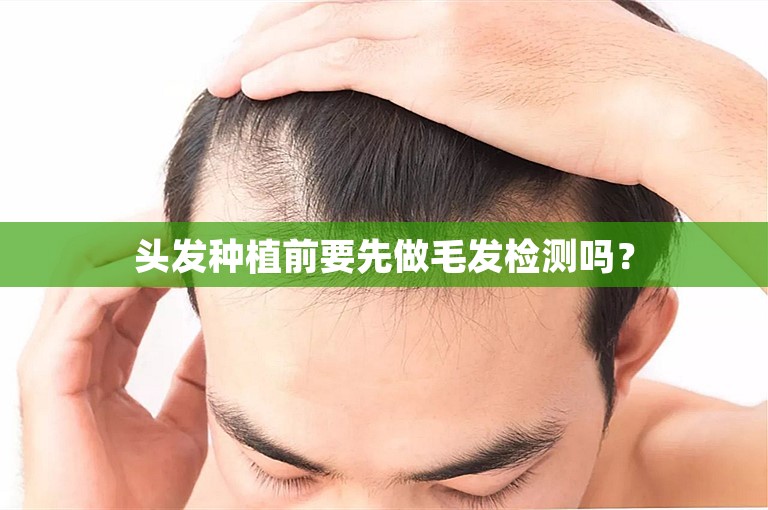 头发种植前要先做毛发检测吗？