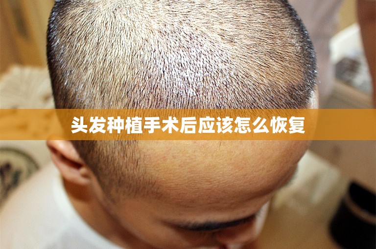 头发种植手术后应该怎么恢复