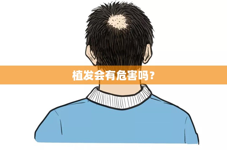 植发会有危害吗？