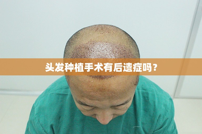 头发种植手术有后遗症吗？