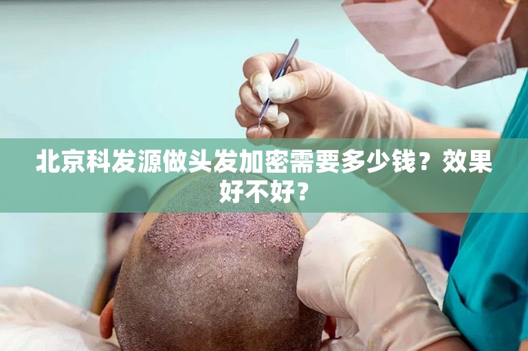 北京科发源做头发加密需要多少钱？效果好不好？