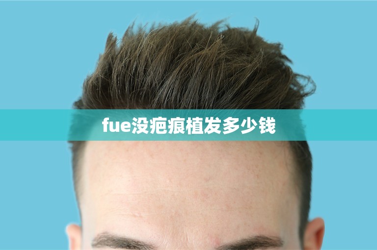 fue没疤痕植发多少钱 fue没疤痕植发多少钱