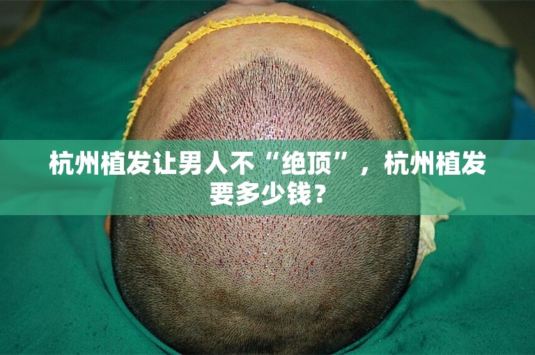 杭州植发让男人不“绝顶”，杭州植发要多少钱？