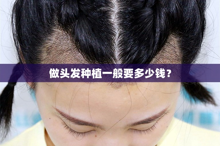 做头发种植一般要多少钱？
