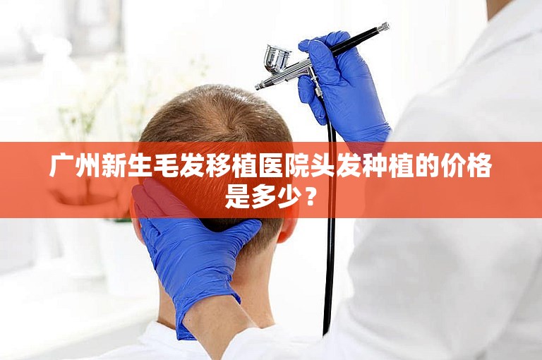 广州新生毛发移植医院头发种植的价格是多少？