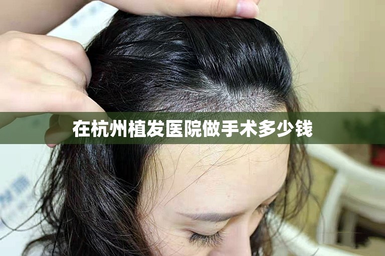 在杭州植发医院做手术多少钱