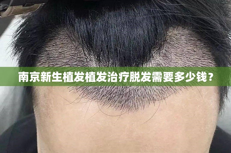 南京新生植发植发治疗脱发需要多少钱？