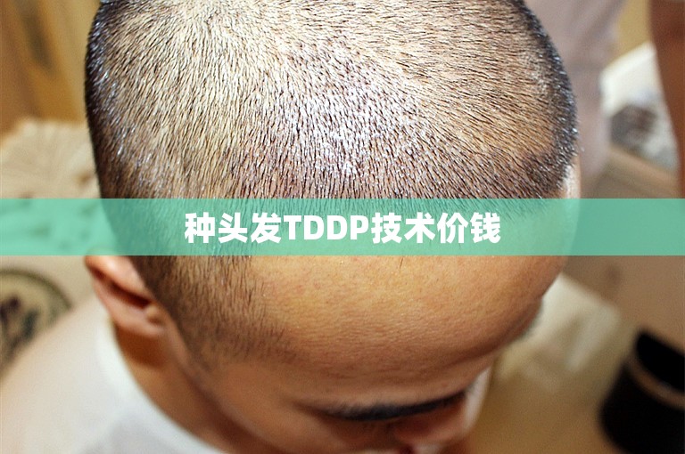 种头发TDDP技术价钱