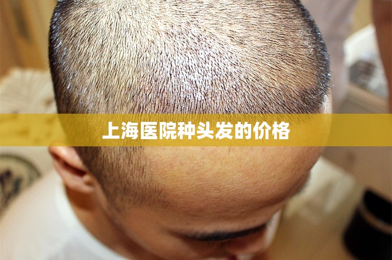上海医院种头发的价格