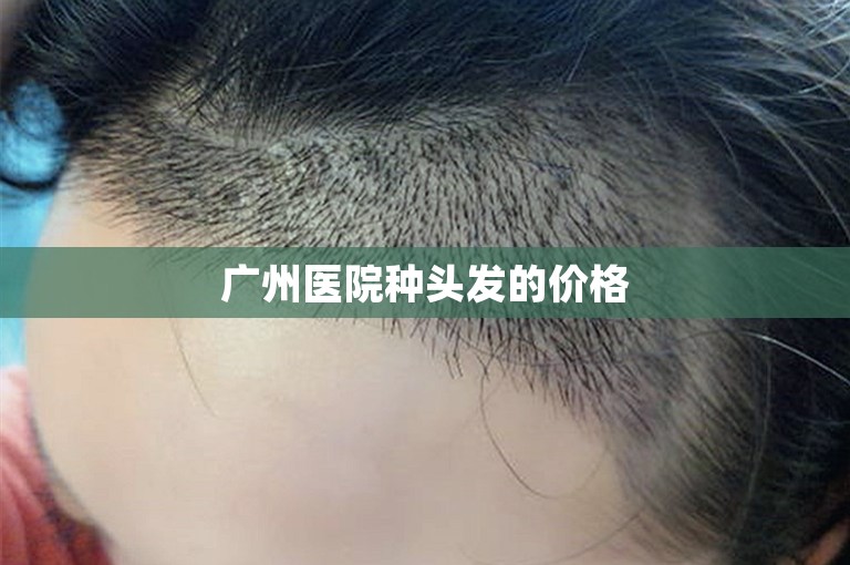 广州医院种头发的价格