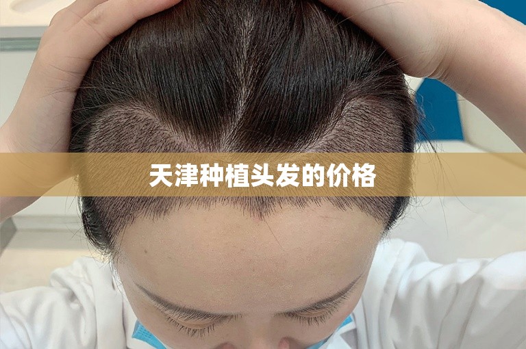 天津种植头发的价格