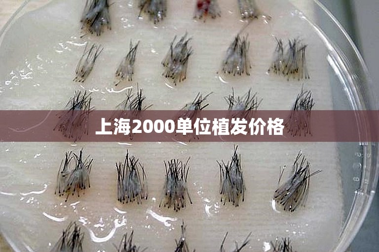 上海2000单位植发价格