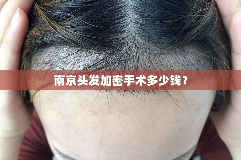 南京头发加密手术多少钱？
