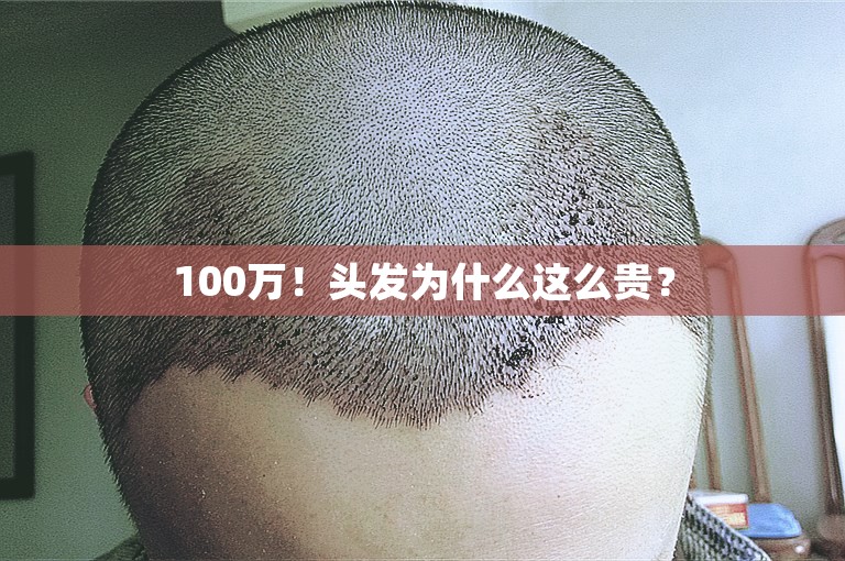 100万！头发为什么这么贵？