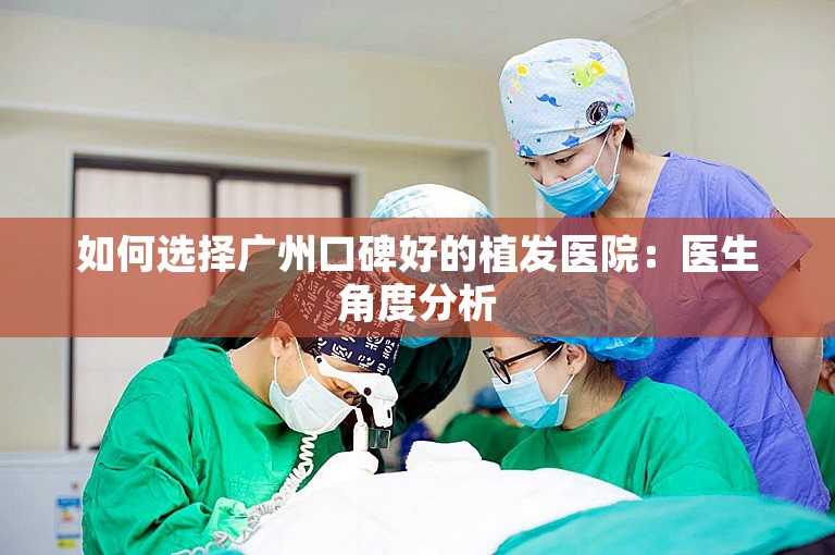 如何选择广州口碑好的植发医院：医生角度分析