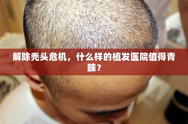 解除秃头危机，什么样的植发医院值得青睐？