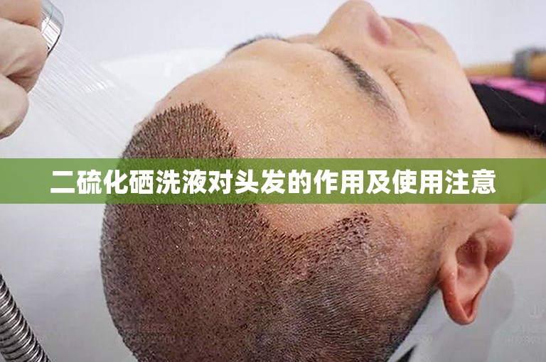 二硫化硒洗液对头发的作用及使用注意