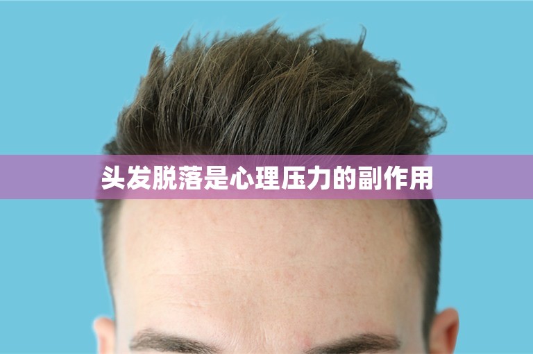 头发脱落是心理压力的副作用 头发脱落是心理压力的副作用