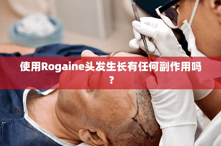 使用Rogaine头发生长有任何副作用吗？
