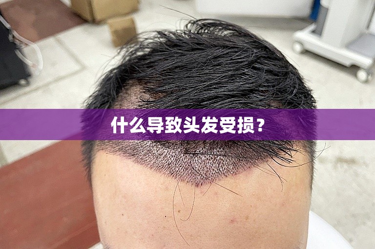 什么导致头发受损？