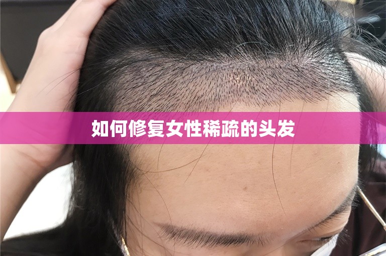 如何修复女性稀疏的头发