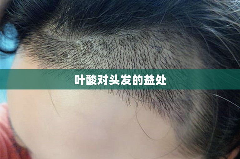 叶酸对头发的益处
