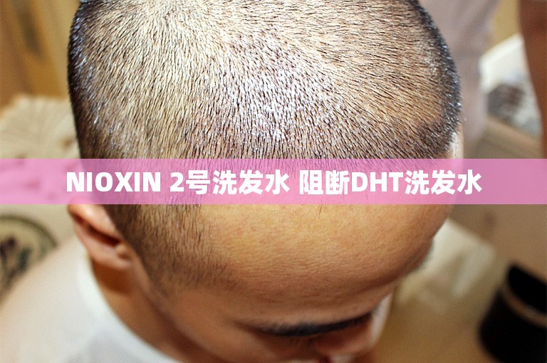 NIOXIN 2号洗发水 阻断DHT洗发水