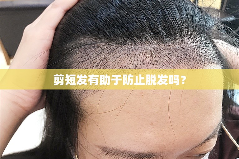 剪短发有助于防止脱发吗？