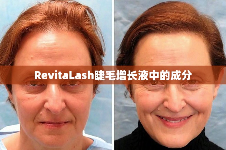 RevitaLash睫毛增长液中的成分