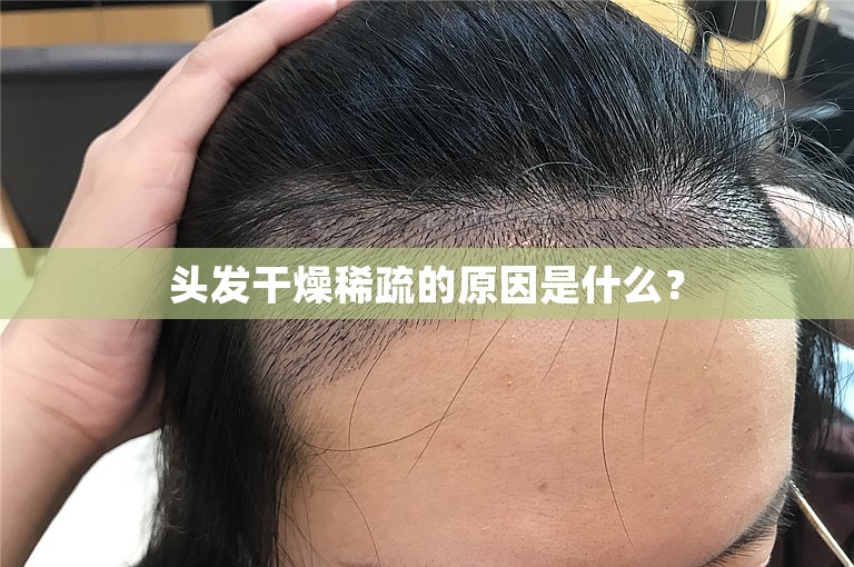 头发干燥稀疏的原因是什么？