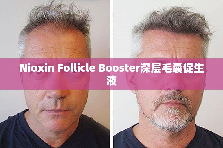 Nioxin Follicle Booster深层毛囊促生液