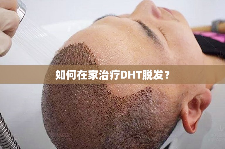 如何在家治疗DHT脱发？