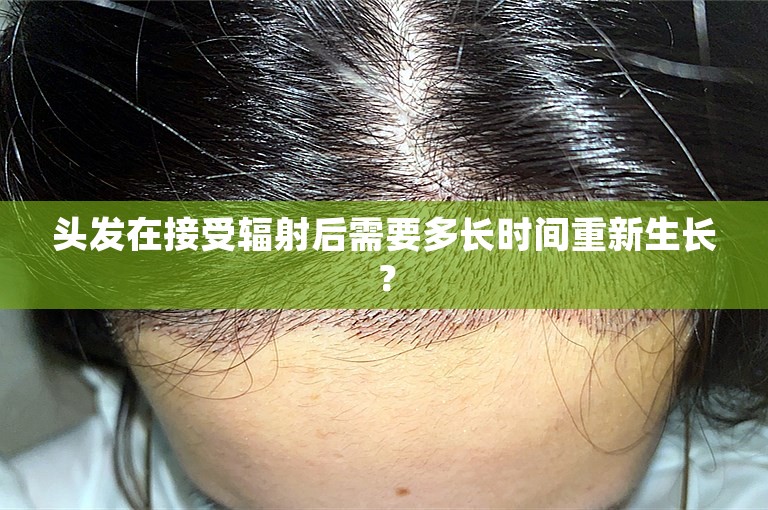 头发在接受辐射后需要多长时间重新生长？