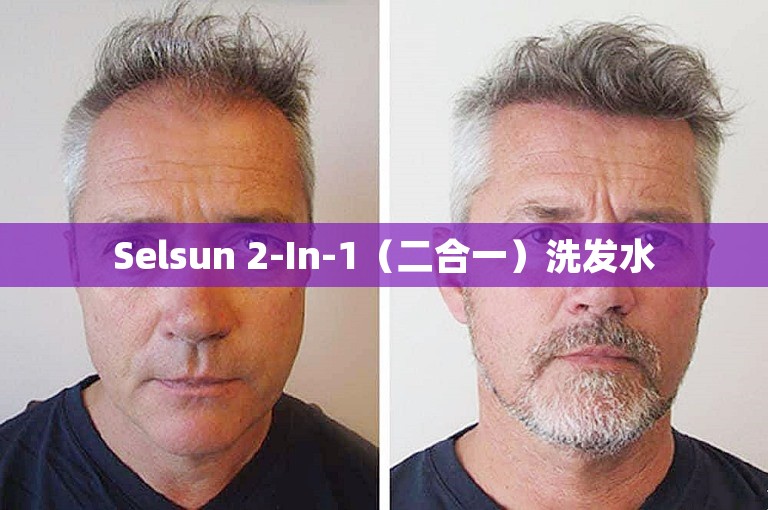 Selsun 2-In-1（二合一）洗发水