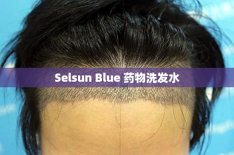 Selsun Blue 药物洗发水