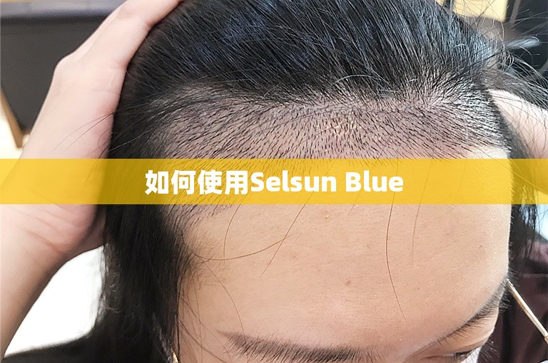 如何使用Selsun Blue