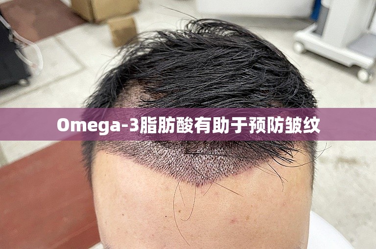 Omega-3脂肪酸有助于预防皱纹