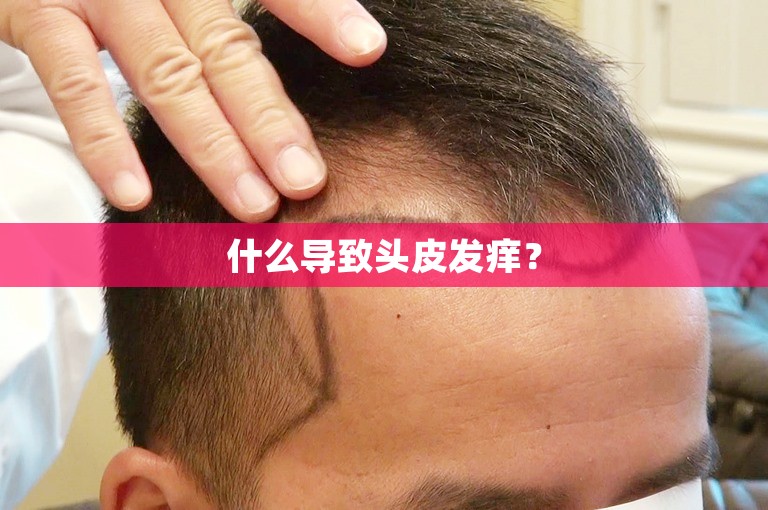 什么导致头皮发痒？