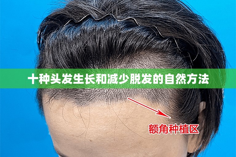 十种头发生长和减少脱发的自然方法