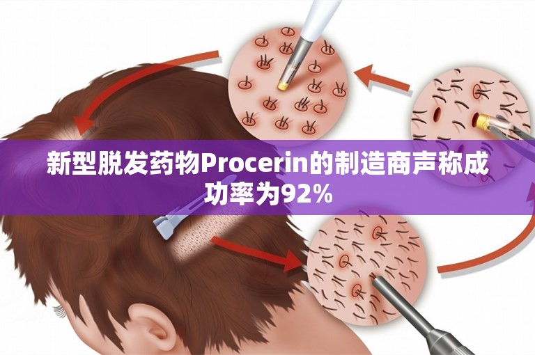 新型脱发药物Procerin的制造商声称成功率为92%