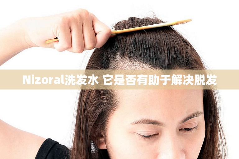 Nizoral洗发水 它是否有助于解决脱发
