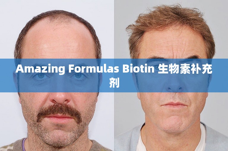 Amazing Formulas Biotin 生物素补充剂