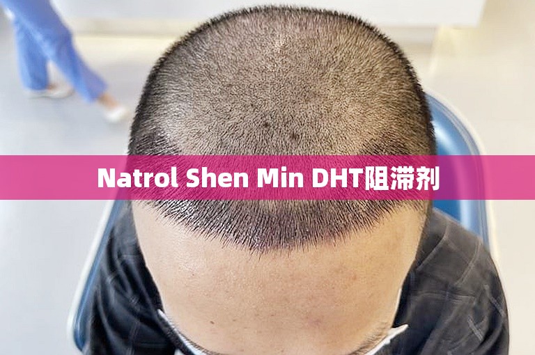 Natrol Shen Min DHT阻滞剂