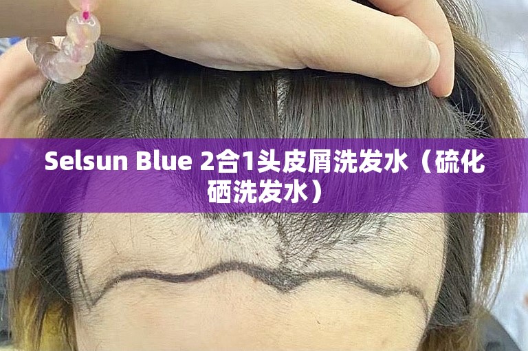 Selsun Blue 2合1头皮屑洗发水（硫化硒洗发水）