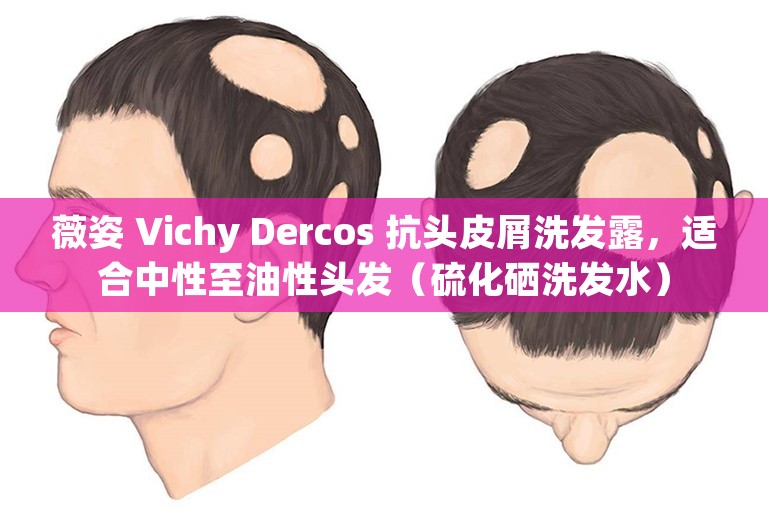 薇姿 Vichy Dercos 抗头皮屑洗发露，适合中性至油性头发（硫化硒洗发水）