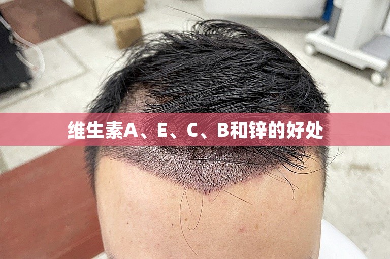 维生素A、E、C、B和锌的好处